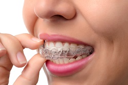 hand holding clear teeth aligners in mouth, Old Bridge, NJ Invisalign
